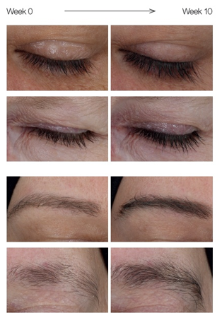 refectocil-brow-booster